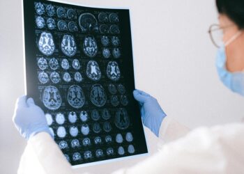 A researcher examines a brain scan with charts and data on Alzheimer’s research displayed.