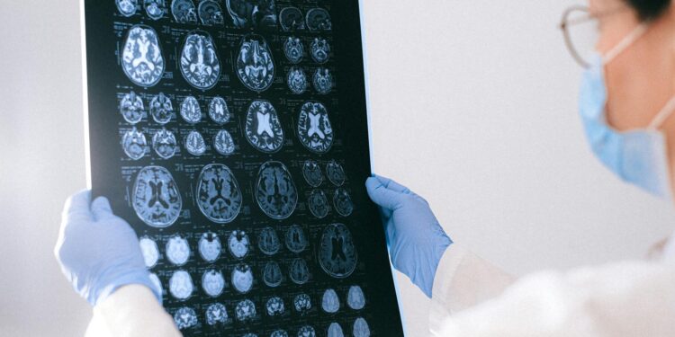 A researcher examines a brain scan with charts and data on Alzheimer’s research displayed.